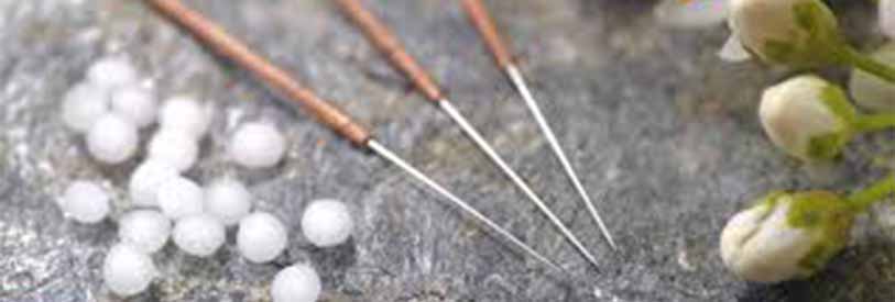 بسیاری از محققان زادگاه طب سوزنی را سرزمین چین می دانند.