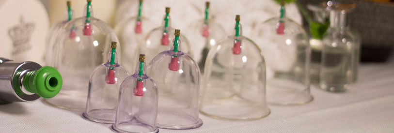 حجامت و بادکش خون اضافه از بدن را گرفته و انرژی دوباره به بدن اعطا می نماید