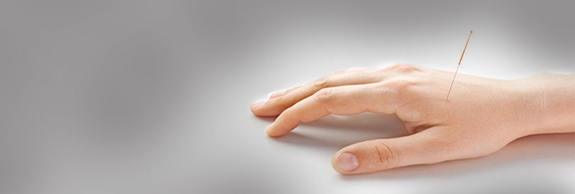 طب سوزنی یکی از شاخه های مهم طب سنتی چین است