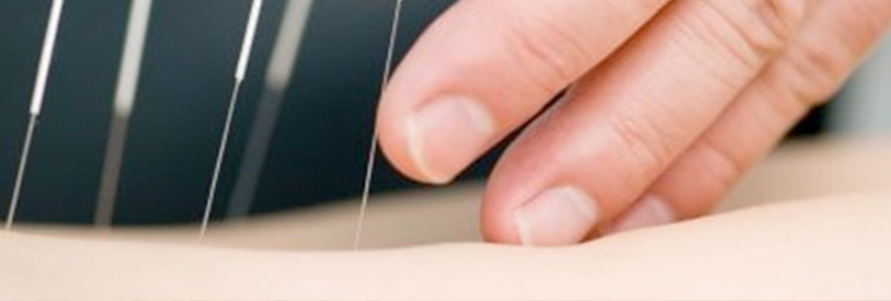 انجام طب سوزنی، مستلزم داشتن تجربه است. 