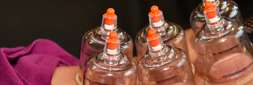 در محل حجامت باید خلا ایجاد کرد. 