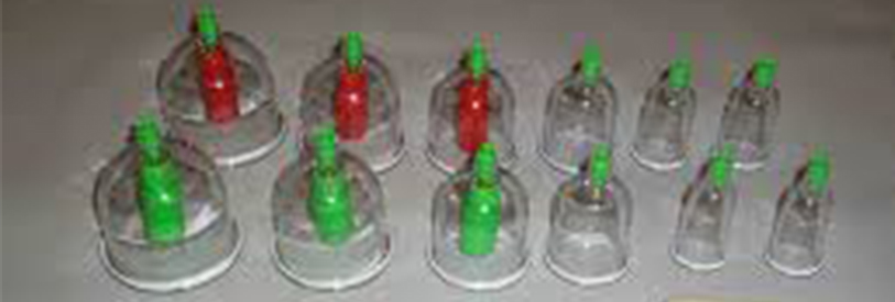 دوره آموزشی حجامت و بادکش درمانی از زیر مجموعه های طب سنتی است.