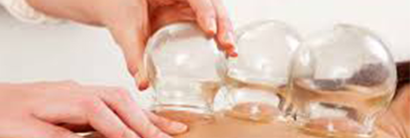  حجامت یکی از روش های درمانی طب سنتی است .