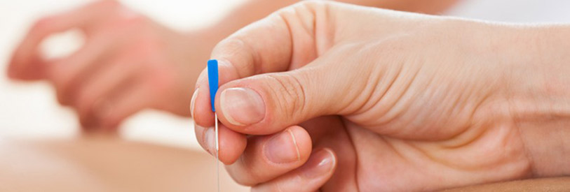 چگونگی عملکرد طب سوزنی بر درمان چاقی 