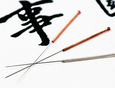 درمان بیماری ها با طب سوزنی